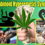 Cannabinoid Hyperemesis Syndrome (CHS)